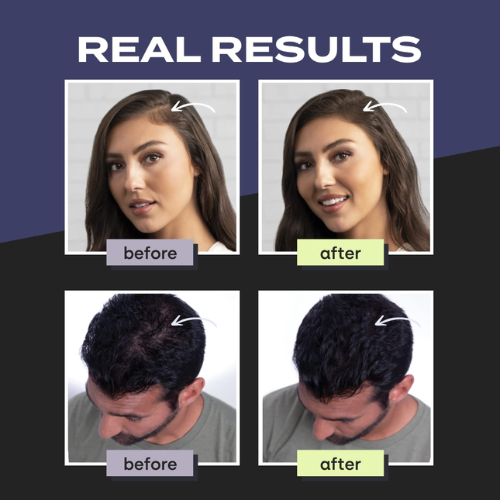 Untitled design (19) Toppik Hair Building Fibers Black 27.5g | Hair Concealer